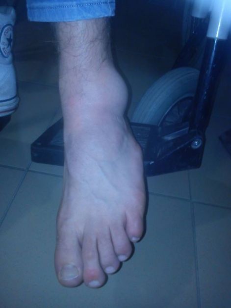 tamas_2._bokaserulese_4..jpg